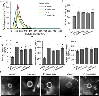 Extracellular Vesicles: A Potential Biomarker for Quick Identification of Infectious Osteomyelitis